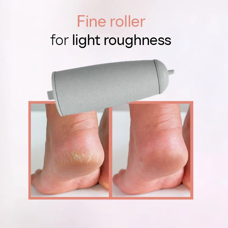 Electric Feet Callus Remover